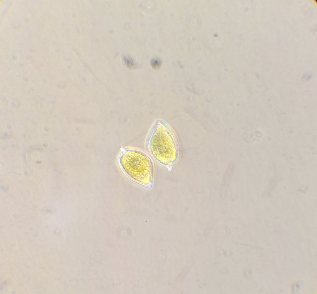 Prorocentrum cells. ©2013 Allison J. Gong