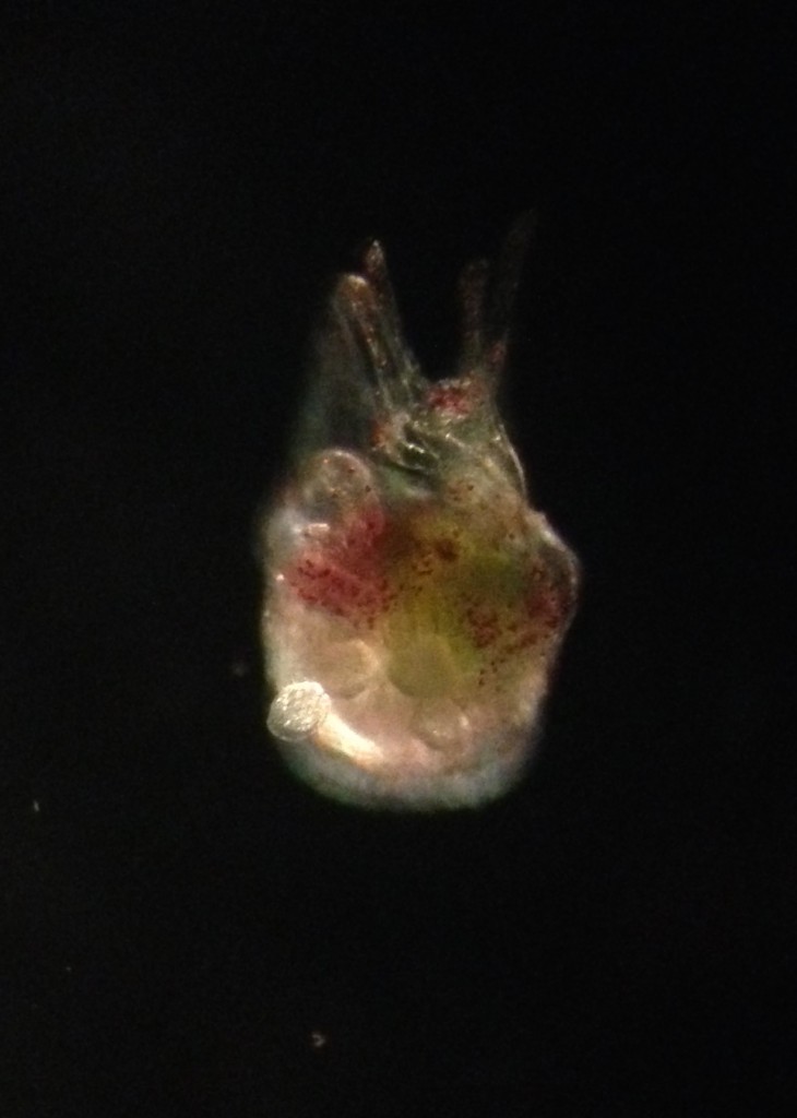 Metamorphosing larva of Strongylocentrotus purpuratus, photographed with dark-field lighting, 8 March 2015. ©Allison J. Gong