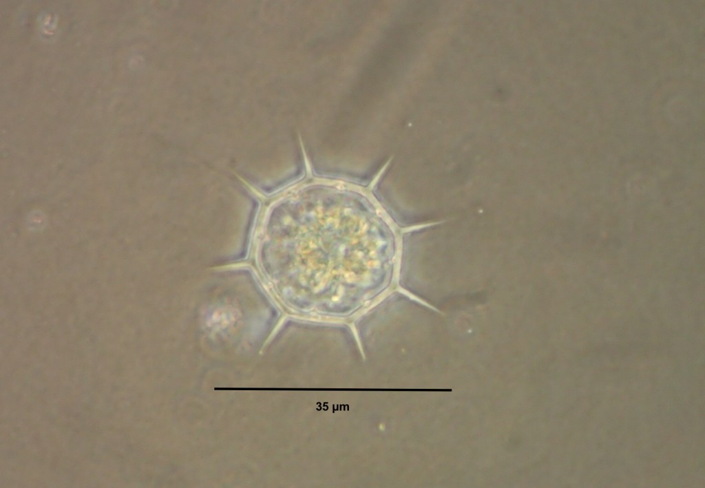 Silicoflagellate in plankton sample collected from Santa Cruz Municipal Wharf, 24 July 2015. © Allison J. Gong