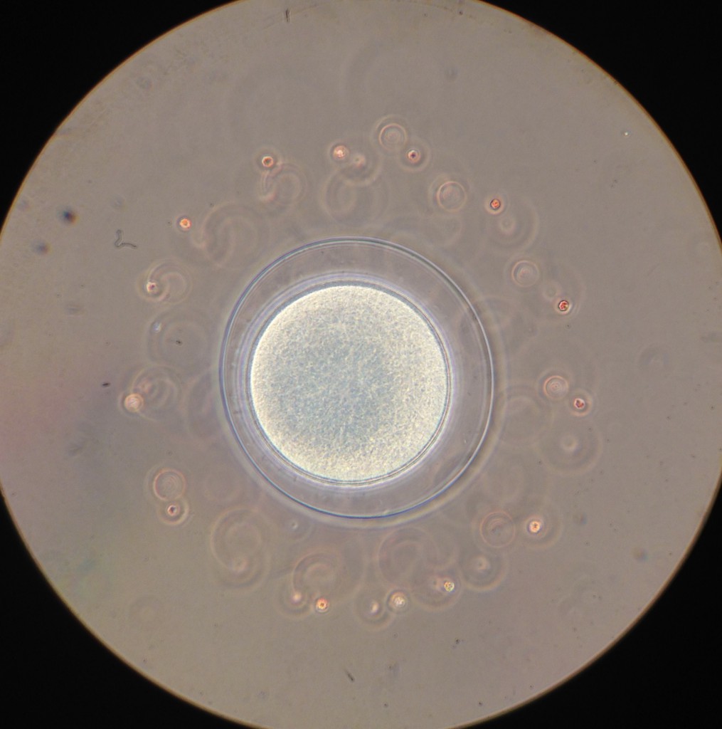 Zygote of D. excentricus. 23 March 2016 © Allison J. Gong